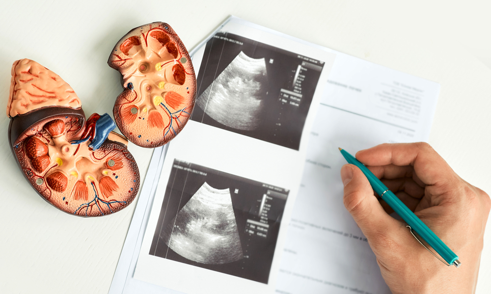 Ultrasonido Renal